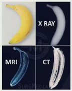 一张图告诉你：MRI、CT、X-ray的区别